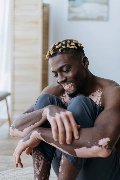 Веселый и без рубашки африканский американец с витилиго сидит на полу дома — стоковое фото