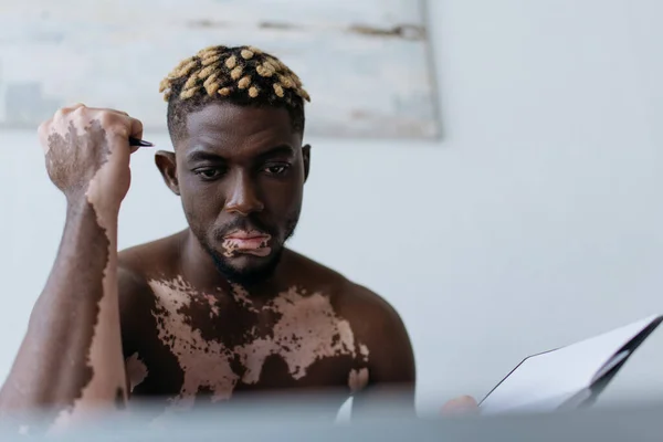 Shirtless Africano americano homem com vitiligo segurando caneta e notebook perto de laptop borrado em casa — Fotografia de Stock