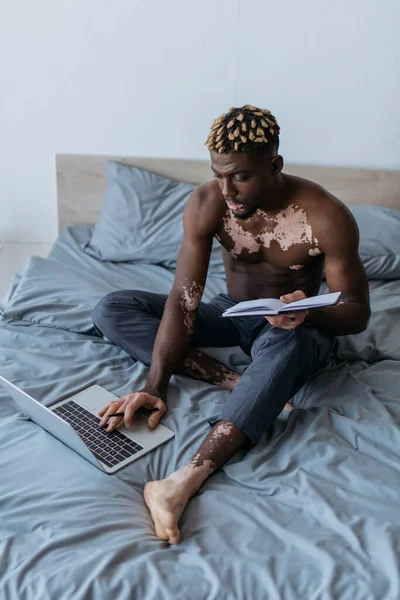 Shirtless african american freelancer with vitiligo holding notebook and using laptop in bedroom — Stock Photo