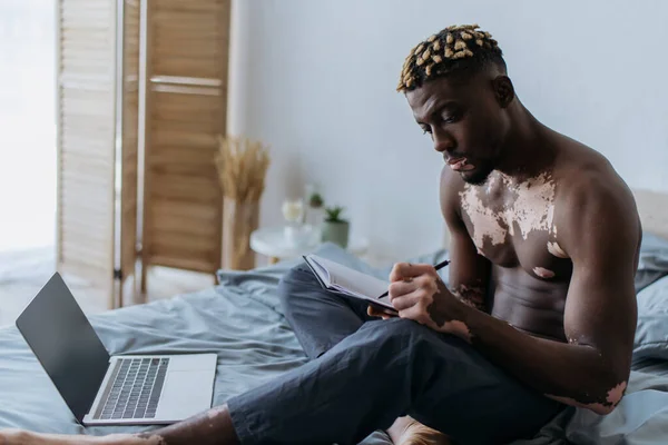 Shirtless african american freelancer with vitiligo writing on notebook near laptop on bed — Stock Photo