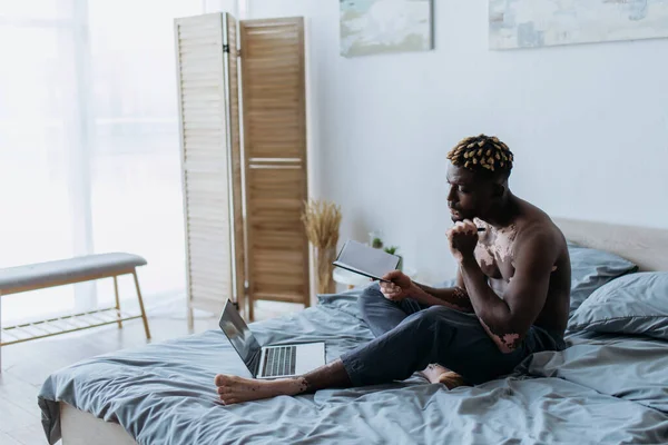 Muscular african american man with vitiligo holding notebook near laptop while working from home — Stock Photo