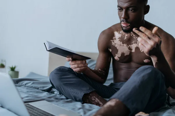Shirtloser afrikanisch-amerikanischer Mann mit Vitiligo-Notizbuch in der Nähe von verschwommenem Laptop im Schlafzimmer — Stockfoto