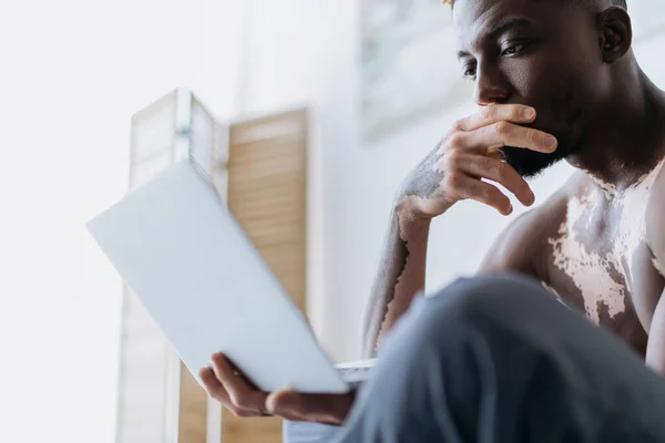 Без сорочки афроамериканський чоловік з вітіліго використовує ноутбук вдома — стокове фото