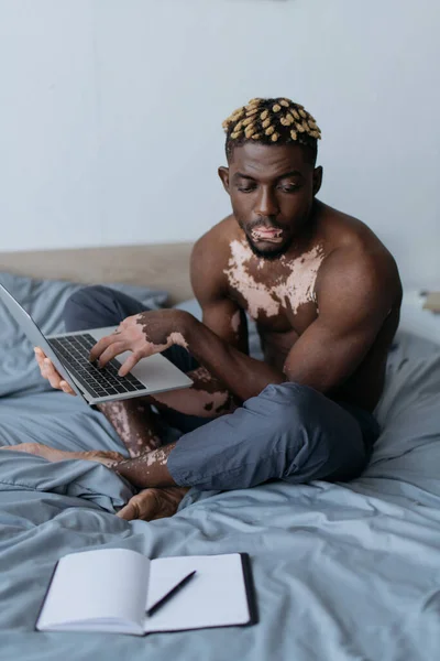 Без сорочки афроамериканський чоловік з вітіліго використовує ноутбук і дивиться на блокнот на ліжку — стокове фото