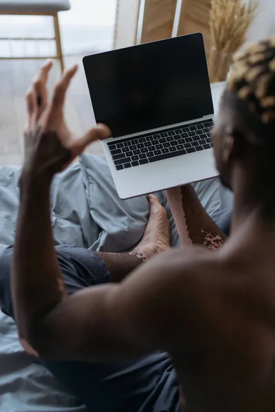 Vista ad alto angolo di uomo afroamericano offuscata con vitiligine avere videochiamata sul computer portatile in camera da letto — Foto stock