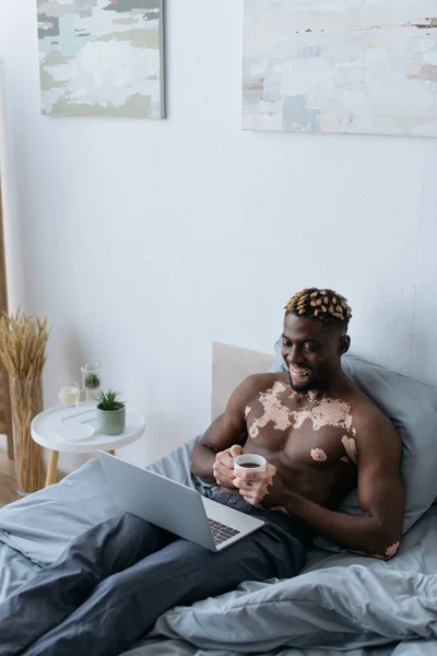 Smiling african american man with vitiligo holding coffee cup and using laptop on bed — Stock Photo