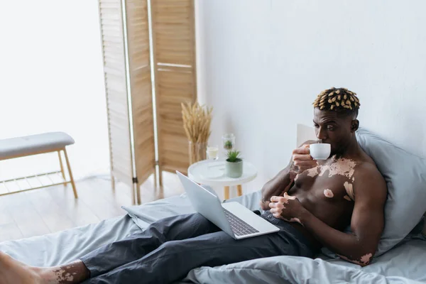 Shirtless african american man with vitiligo drinking coffee and using laptop on bed — Stock Photo
