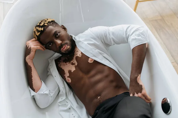 Vue du dessus de l'homme musclé afro-américain avec vitiligo regardant la caméra de la baignoire à la maison — Photo de stock