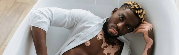 Vista dall'alto dell'uomo afroamericano con vitiligine in camicia sdraiato nella vasca da bagno a casa, banner — Foto stock