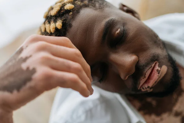 Retrato de hombre afroamericano con vitiligo sentado en una bañera borrosa en casa - foto de stock