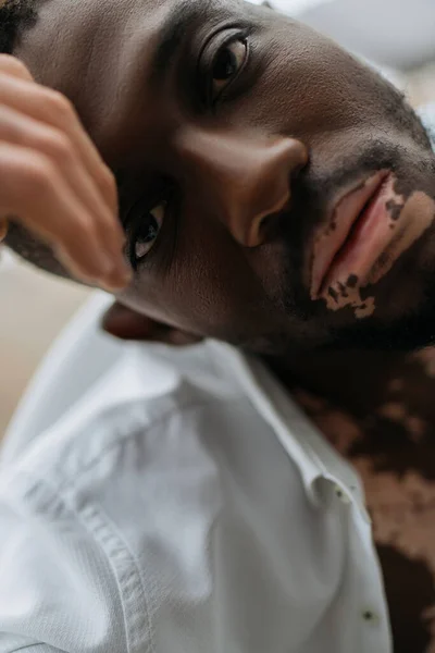 Retrato de hombre afroamericano con vitiligo en camisa blanca sentado en la bañera borrosa en casa - foto de stock