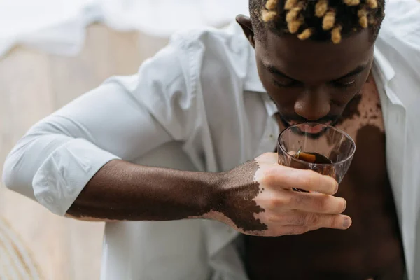 Hombre afroamericano con vitiligo sosteniendo un vaso de whisky mientras está sentado en la bañera - foto de stock