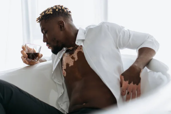Seitenansicht eines afrikanisch-amerikanischen Mannes mit Vitiligo, der ein Glas Whiskey in der Badewanne hält — Stockfoto