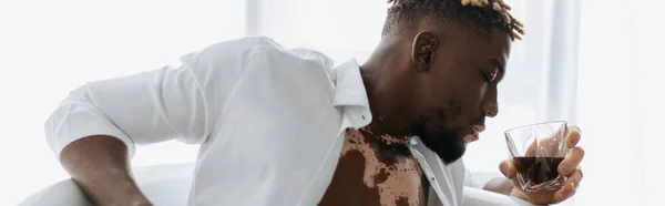 Seitenansicht eines afrikanisch-amerikanischen Mannes mit Vitiligo im weißen Hemd, der Whiskey in der Badewanne hält, Banner — Stockfoto