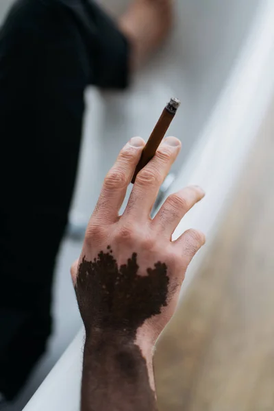 Vista recortada del hombre afroamericano con vitiligo sosteniendo cigarro en la bañera en casa - foto de stock