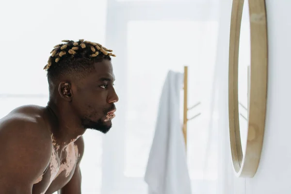 Без сорочки афроамериканський чоловік з вітіліго дивиться на дзеркало у ванній — стокове фото