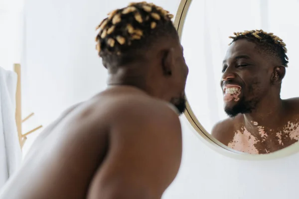 Blurred african american man with vitiligo looking at teeth in mirror at home — Stock Photo