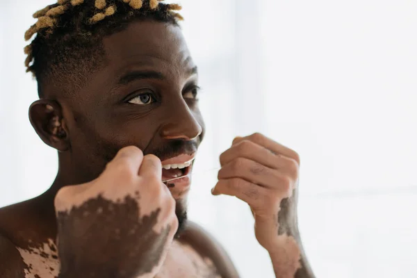Hombre afroamericano sin camisa con vitiligo usando hilo dental en casa - foto de stock