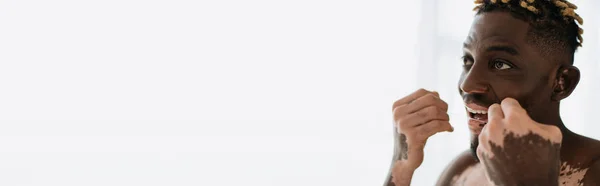 Shirtless afro-americano com vitiligo usando fio dental em casa, banner — Fotografia de Stock