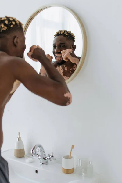 Sans chemise homme afro-américain avec des dents en soie dentaire vitiligo près du miroir dans la salle de bain — Photo de stock