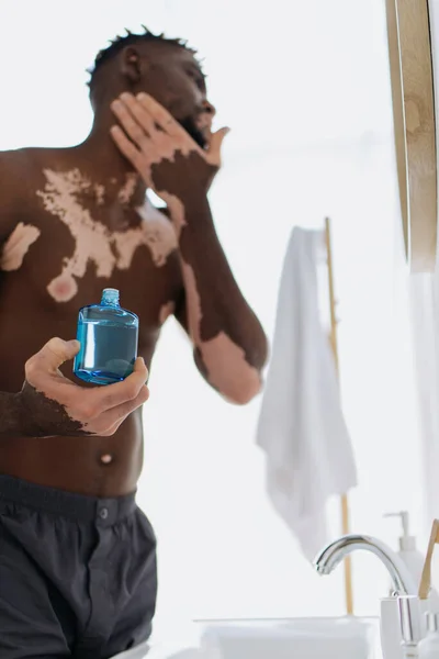 Розмитий афроамериканець з вітиліго застосовує лосьйон на обличчі у ванній кімнаті. — стокове фото