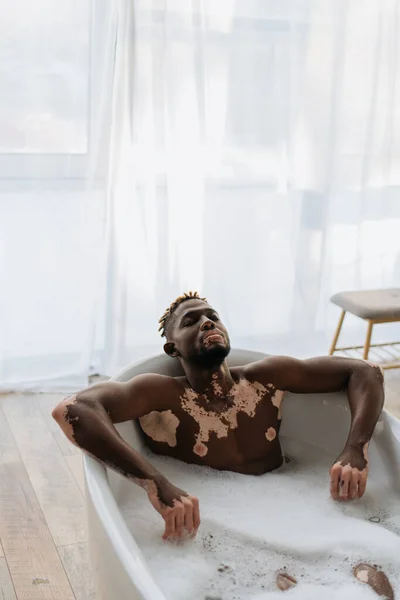 Hombre afroamericano con vitiligo sentado en la bañera con espuma en casa - foto de stock