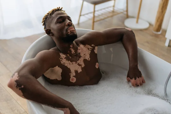 Joven afroamericano hombre con vitiligo relajante en la bañera en casa - foto de stock