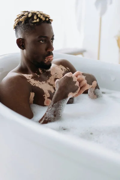 Hombre afroamericano con vitiligo sentado en la bañera con espuma en el baño - foto de stock