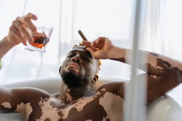 Hombre afroamericano con vitiligo sosteniendo cigarro y vaso de bourbon mientras toma un baño en casa - foto de stock