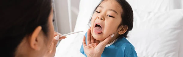 Niño asiático con la boca abierta cerca del médico con depresor de la lengua en primer plano borroso en la sala del hospital, bandera - foto de stock
