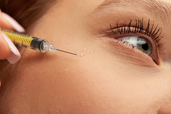 Close up da seringa com ácido hialurônico ou enchimento perto da face da jovem mulher em fundo cinza — Fotografia de Stock