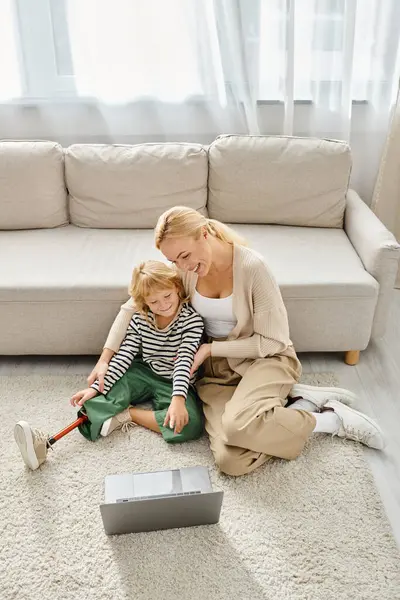 Happy child with prosthetic leg watching movie on laptop and sitting on carpet together with mother — Stock Photo