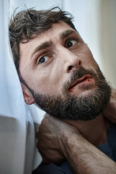 Ansioso hombre deprimido en camiseta casual mordiéndose los labios hasta la sangre durante el colapso, la salud mental - foto de stock