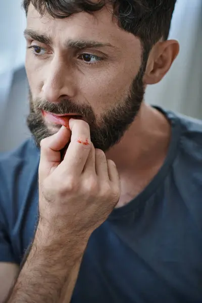 Тревожный депрессивный человек в повседневной футболке кусает губы до крови во время срыва, психического здоровья — стоковое фото