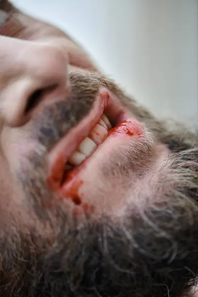 Vista recortada del hombre ansioso mordiéndose los labios hasta la sangre durante el episodio depresivo, salud mental - foto de stock