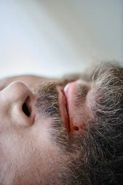 Vista recortada del hombre ansioso mordiéndose los labios hasta la sangre durante el episodio depresivo, salud mental - foto de stock