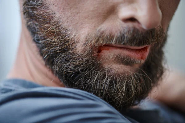 Обрезанный вид тревожного человека, кусающего губы до крови во время депрессивного эпизода, психического здоровья — стоковое фото