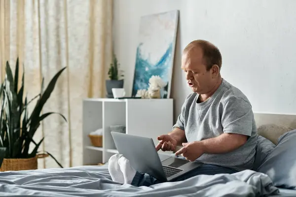 Ein inklusiver Mann sitzt auf seinem Bett, vertieft in seinen Laptop. — Stockfoto