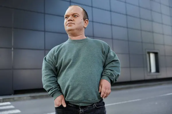 Ein Mann mit Inklusivität steht selbstbewusst vor einem modernen Gebäude, die Hände in den Taschen, während er in Richtung Stadt blickt.. — Stockfoto
