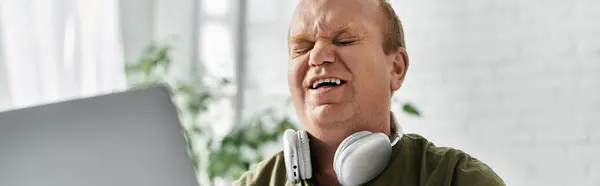 Ein Mann mit Inklusion singt Musik mit, während er zu Hause Kopfhörer trägt. — Stockfoto