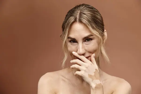 A young woman with vitiligo poses for a portrait, covering her mouth with her hand and smiling softly at the camera. — Stock Photo