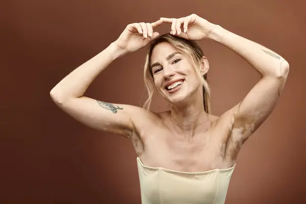 A young woman with vitiligo and a tattoo poses with her arms raised, smiling brightly against a beige background. — Stock Photo