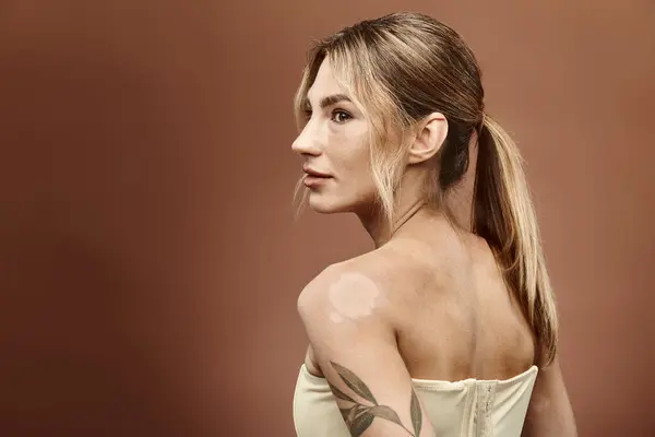 Una giovane donna con la vitiligine posa con fiducia con le spalle nude su uno sfondo beige. — Foto stock