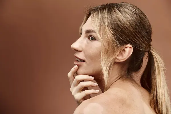 Una giovane donna con la vitiligine posa su uno sfondo beige. Lei indossa una spalla nuda e i suoi capelli sono tirati indietro in una coda di cavallo. — Foto stock