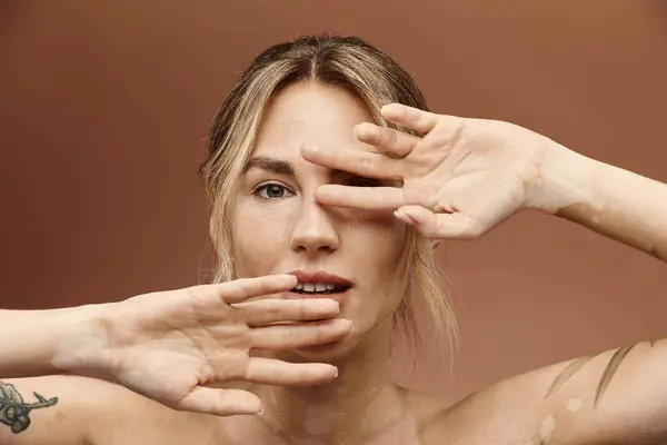 Une jeune femme avec vitiligo pose avec confiance avec ses épaules nues, mettant en valeur sa beauté unique. — Photo de stock