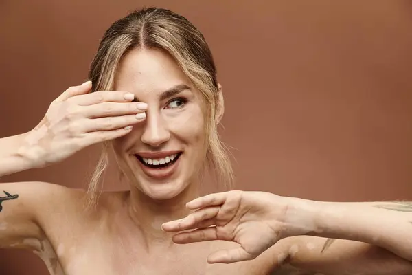 Una giovane donna con la vitiligine posa con le spalle nude, sorridendo mentre copre un occhio con la mano. — Foto stock