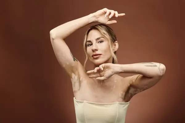 A young woman with vitiligo poses confidently, showcasing her tattoo and embracing her unique beauty. — Stock Photo