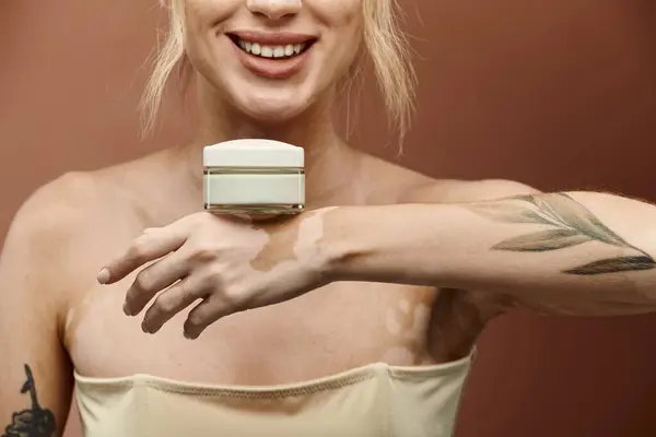 Uma jovem mulher com vitiligo sorri e segura um pote de creme na mão contra um fundo bege. — Fotografia de Stock