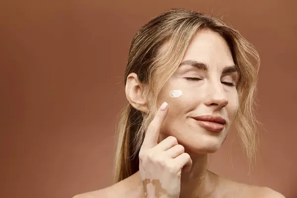 A young woman with vitiligo applies cream to her face against a beige background. — Stock Photo