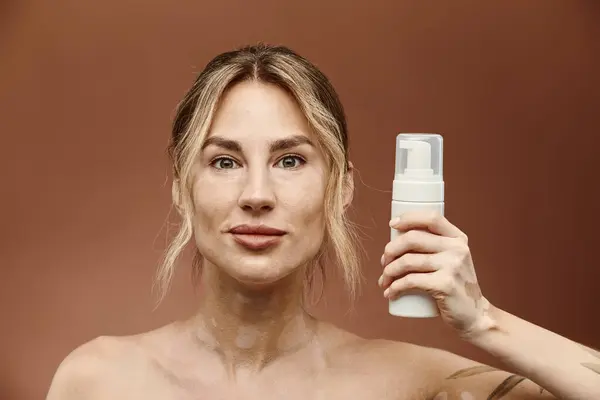 A young woman with vitiligo holds a skin care product in front of a beige background. — Stock Photo